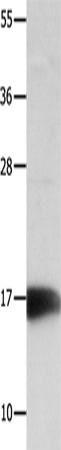 Rabbit Polyclonal Antibody to NME3