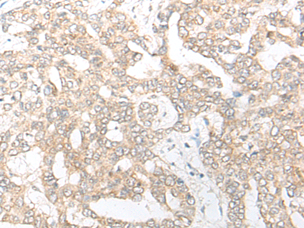 Rabbit Polyclonal Antibody to NME4