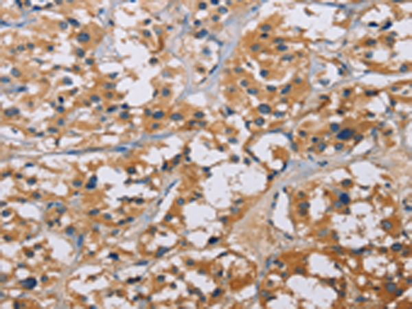 Rabbit Polyclonal Antibody to NME5