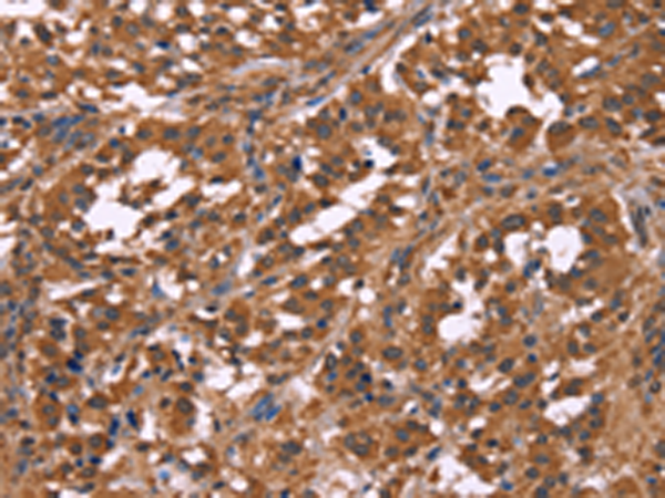 Rabbit Polyclonal Antibody to NOS2