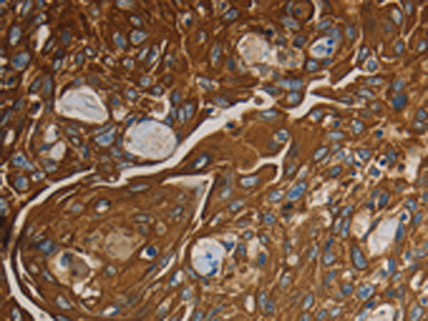 Rabbit Polyclonal Antibody to NRP1