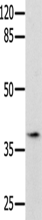 Rabbit Polyclonal Antibody to BDNF