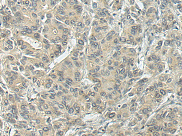 Rabbit Polyclonal Antibody to NTF3