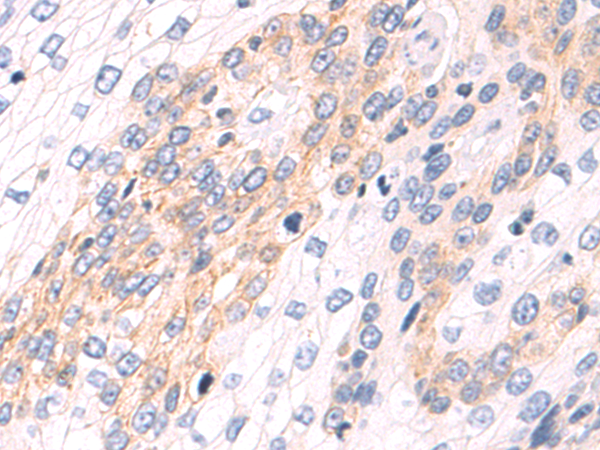 Rabbit Polyclonal Antibody to NR4A2