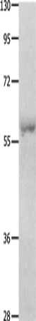 Rabbit Polyclonal Antibody to OASL