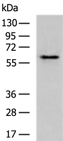 Rabbit Polyclonal Antibody to OCLN