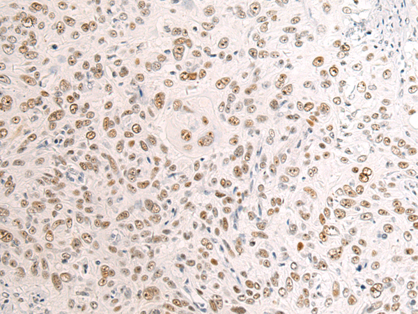 Rabbit Polyclonal Antibody to RB1
