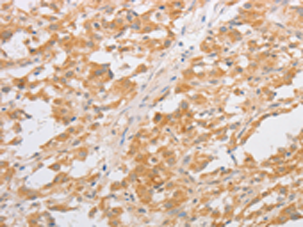Rabbit Polyclonal Antibody to CDKN2AIP