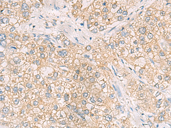 Rabbit Polyclonal Antibody to MAPK14