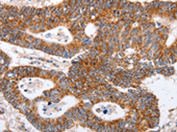 Rabbit Polyclonal Antibody to MAP2K5