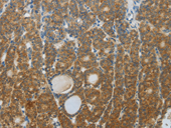 Rabbit Polyclonal Antibody to DNAJC3