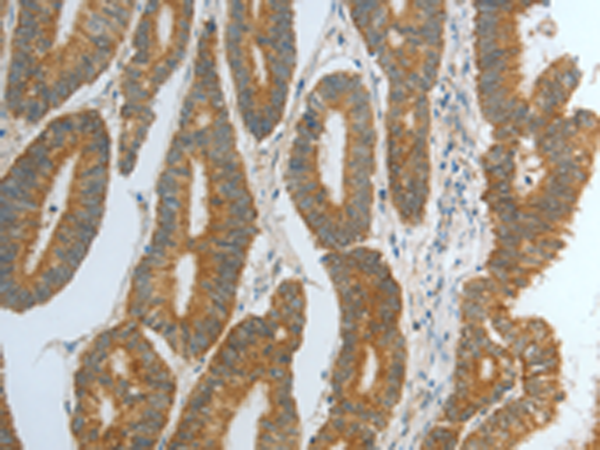 Rabbit Polyclonal Antibody to DNAJC10