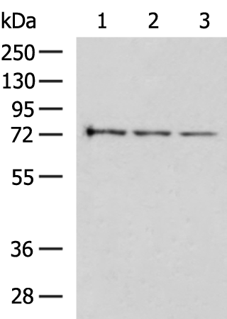 Rabbit Polyclonal Antibody to TP73