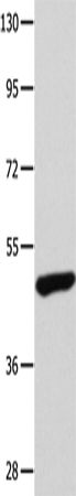 Rabbit Polyclonal Antibody to TP63
