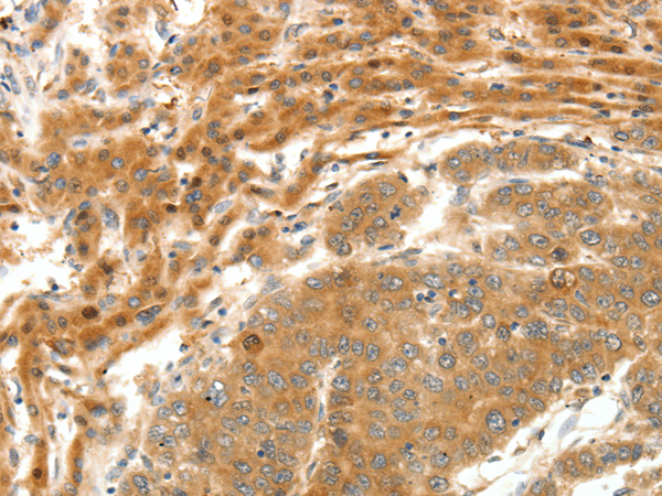 Rabbit Polyclonal Antibody to SERPINE1
