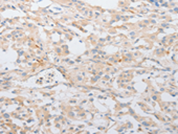 Rabbit Polyclonal Antibody to SERPINE2