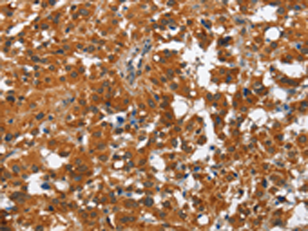 Rabbit Polyclonal Antibody to PAK2