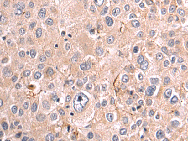 Rabbit Polyclonal Antibody to PAK4