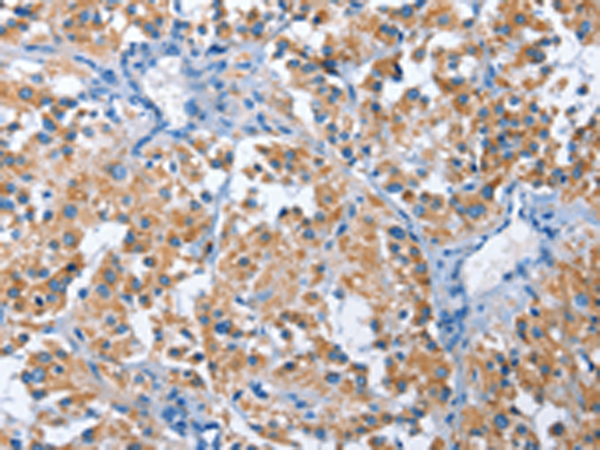 Rabbit Polyclonal Antibody to PAK6
