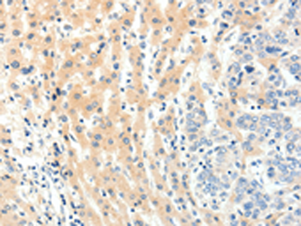 Rabbit Polyclonal Antibody to PAK5