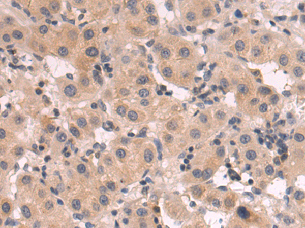 Rabbit Polyclonal Antibody to FAM3A