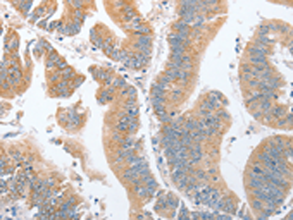 Rabbit Polyclonal Antibody to PARD6A