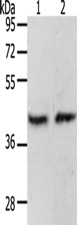 Rabbit Polyclonal Antibody to PAX8