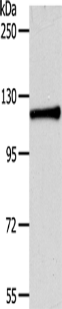 Rabbit Polyclonal Antibody to CDH3