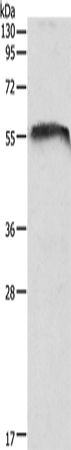 Rabbit Polyclonal Antibody to CDH23