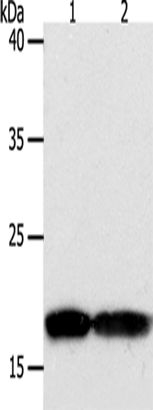 Rabbit Polyclonal Antibody to PDCD6