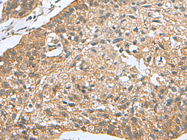 Rabbit Polyclonal Antibody to PDCD5