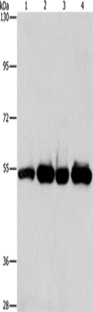 Rabbit Polyclonal Antibody to PDE4D