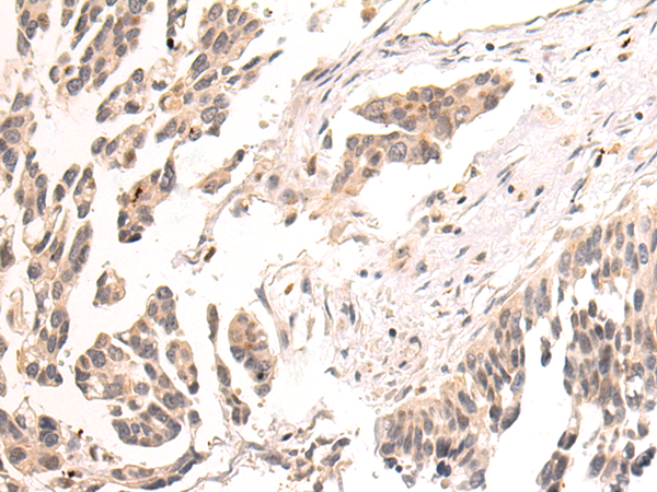 Rabbit Polyclonal Antibody to SPDEF