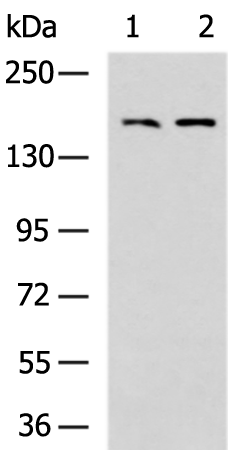 Rabbit Polyclonal Antibody to PDGFRB