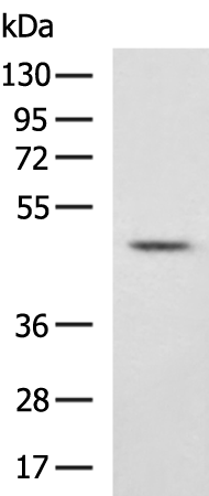 Rabbit Polyclonal Antibody to SERPINF1