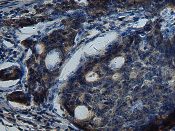 Rabbit Polyclonal Antibody to EIF2AK3
