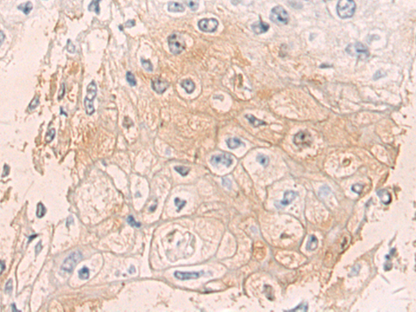 Rabbit Polyclonal Antibody to GRN
