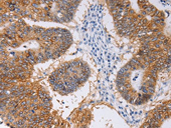 Rabbit Polyclonal Antibody to PIWIL1