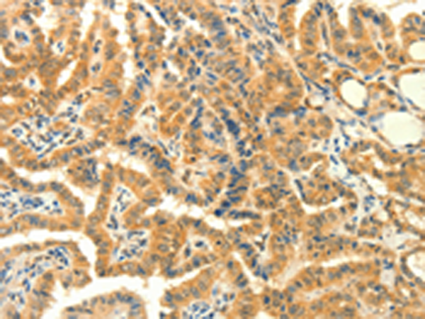 Rabbit Polyclonal Antibody to PRKACG