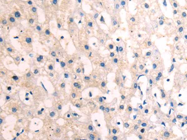 Rabbit Polyclonal Antibody to PLAU