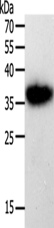 Rabbit Polyclonal Antibody to PLAUR