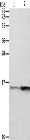 Rabbit Polyclonal Antibody to PFN1