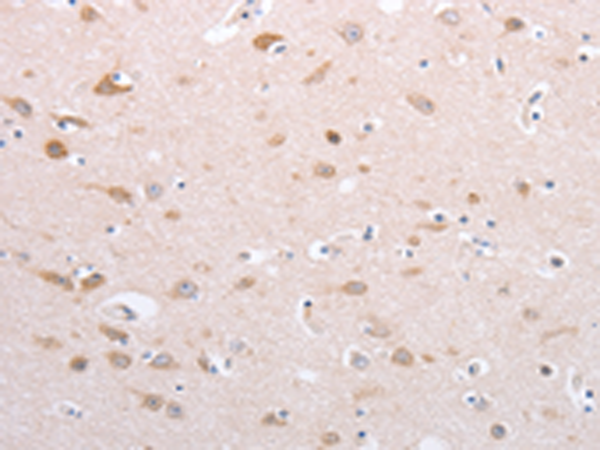 Rabbit Polyclonal Antibody to PFN4