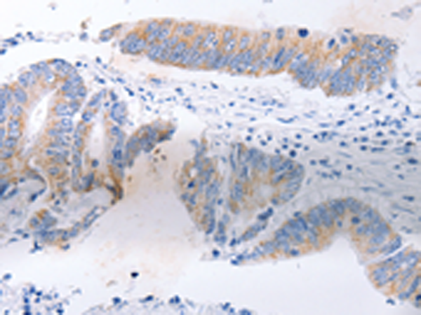 Rabbit Polyclonal Antibody to SERP1