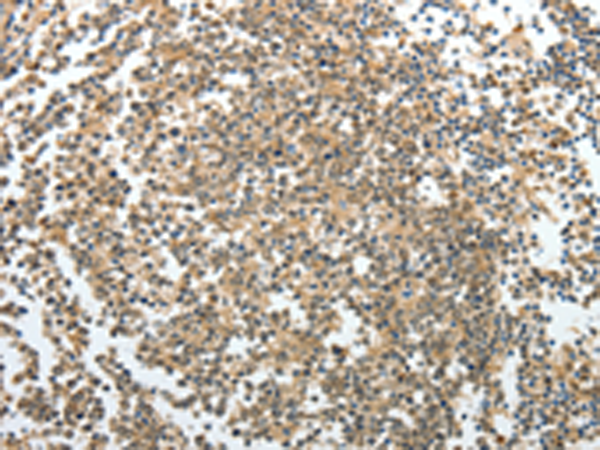 Rabbit Polyclonal Antibody to PRMT2