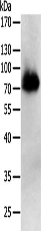 Rabbit Polyclonal Antibody to PRMT7