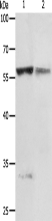 Rabbit Polyclonal Antibody to PRCP