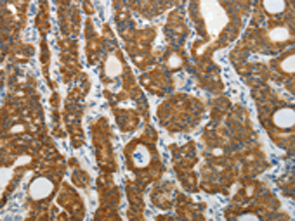 Rabbit Polyclonal Antibody to PRDX5