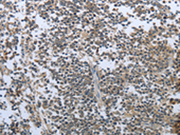 Rabbit Polyclonal Antibody to PRL