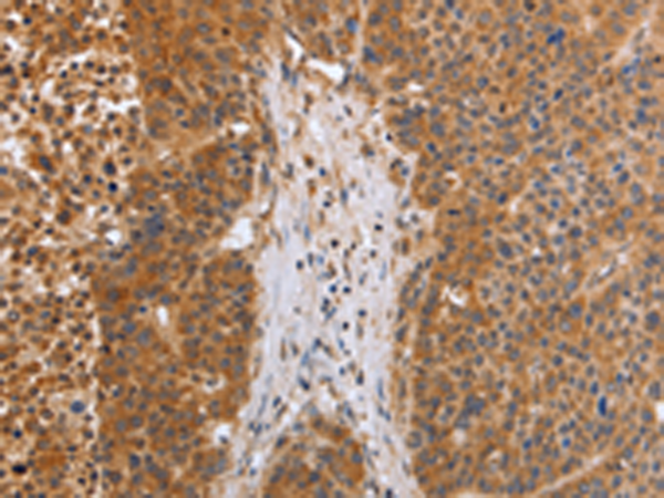 Rabbit Polyclonal Antibody to EGLN3